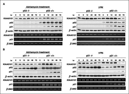 Figure 5. Regulation of KIAA0101 expression by the p53-p21 pathway. A, RT-PCR and Western blot analysis for KIAA0101 expression in HCT116 p53+/+ and p53−/− cells at various time points after treatment with 0.5 μg/mL Adriamycin or after exposure to 14 Gy γ-ray. KIAA0101 expression was decreased in the HCT116 p53+/+ cells in protein level (top column) and mRNA level (bottom column) in accordance with induction of endogenous p53 by Adriamycin treatment (left) or irradiation exposure (right). On the other hand, no suppression of KIAA0101 expression was observed in HCT116 p53−/− cells. β-Actin protein and β2MG RNA served as quantitative controls. B, RT-PCR and Western blot analysis of KIAA0101 expression in HCT116 p21+/+ and p21−/− cells at various time points after treatment with 0.5 μg/mL Adriamycin or after exposure to 14 Gy γ-ray. KIAA0101 expression in HCT116 p21−/− cells was not suppressed by Adriamycin treatment (left) or irradiation exposure (right), whereas KIAA0101 expression was drastically decreased in the wild-type HCT116 p21+/+ cells in its RNA and protein level.
