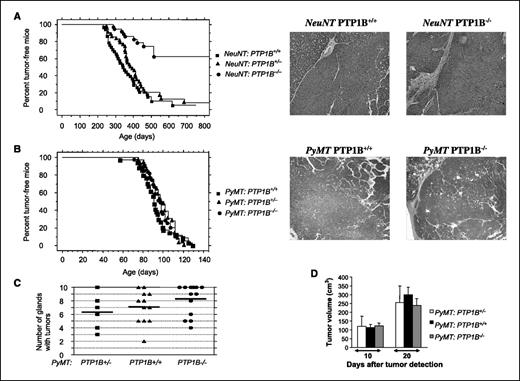 Figure 1. PTP1B is required for NeuNT-evoked but not PyMT-evoked mammary tumorigenesis. A, left, Kaplan-Meier curves showing mammary tumor onset in MMTV-NeuNT: PTP1B+/+ mice (n = 38), MMTV-NeuNT: PTP1B+/− mice (n = 42), and MMTV-NeuNT: PTP1B−/− mice (n = 37). MMTV-NeuNT: PTP1B+/+ and MMTV-NeuNT: PTP1B+/− developed palpable tumors by a mean probability of 395 d (±15) and 421 d (±24), respectively (P = 0.14). Only 10 MMTV-NeuNT: PTP1B−/− mice developed a tumor by 481 d (±24). P < 0.0001, PTP1B−/− versus PTP1B+/+ or PTP1B+/− mice expressing NeuNT. Right, H&E-stained sections of mammary tumors from MMTV-NeuNT: PTP1B+/+ and MMTV-NeuNT: PTP1B−/− mice. B, left, Kaplan-Meier curves showing mammary tumor onset in the indicated genotypes. MMTV-PyMT: PTP1B+/+ mice (n = 34), MMTV-PyMT: PTP1B+/− mice (n = 36), and MMTV-PyMT: PTP1B−/− mice (n = 39). P = 0.42, comparing MMTV-PyMT: PTP1B+/+ and MMTV-PyMT: PTP1B−/− (left). Right, H&E-stained sections of mammary tumors from MMTV-PyMT: PTP1B+/+ and MMTV-PyMT: PTP1B−/− mice. C, tumor volume from MMTV-PyMT: PTP1B+/− (n = 4), MMTV-PyMT: PTP1B+/+ (n = 9), and MMTV-PyMT: PTP1B−/− (n = 11) mice, 10 and 20 d after tumor onset (gland 1). P = 0.7 (at 10 d) and P = 0.3 (at 20 d), comparing MMTV-PyMT: PTP1B+/+ and MMTV-PyMT: PTP1B−/− mice. D, number of glands with tumors from MMTV-PyMT: PTP1B+/− mice (n = 6), MMTV-PyMT: PTP1B+/+ mice (n = 12), and MMTV-PyMT: PTP1B−/− mice (n = 14), 20 to 26 d after tumor onset. P = 0.2, comparing MMTV-PyMT: PTP1B+/+ and MMTV-PyMT: PTP1B−/− mice.