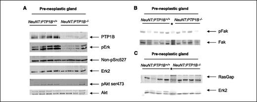 Figure 2. Effect of PTP1B deficiency on HER2 signaling in preneoplastic mammary gland. A to C, immunoblots of total lysates from preneoplastic mammary glands from MMTV-NeuNT: PTP1B+/+, MMTV-NeuNT: PTP1B−/−, and MMTV-NeuNT: PTP1B+/− (*) mice (>14 mo old) were immunoblotted with the indicated antibodies.