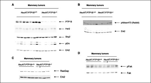Figure 3. Effect of PTP1B deficiency on HER2 signaling in tumor lysates. A to D, lysates of breast tumors from MMTV-NeuNT: PTP1B+/+ and MMTV-NeuNT: PTP1B−/− mice were subjected to immunoblotting with the indicated antibodies. *, lysates of breast tumor from MMTV-NeuNT: PTP1B+/− mice.