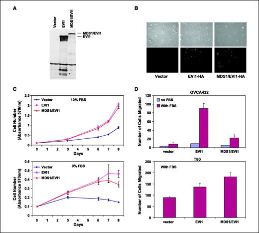 Figure 3. EVI1 and MDS1/EVI1 alter ovarian cell–proliferative and migratory responses. A, EVI1 and MDS1/EVI1 were overexpressed in T80 cells. Lysates were harvested, and Western analysis was done using Hirai's polyclonal antibody. B, EVI1-HA and MDS1/EVI1-HA were overexpressed in T80 cells and stained for HA to visualize nuclear overexpression. C, effect of EVI1 and MDS1/EVI1 on proliferation of T80 cells was done in 10% FBS (top) and 0% FBS (bottom). The growth assay was done in 96-well plates where cells were plated at 5,000 cells per well and grown in 10% FBS (top) and 0% FBS (bottom). Cells were stained in crystal violet solution and solubilized with Sorenson's buffer and quantitated at absorbance of 570 nm. Experiments were done in triplicate. D, the ability of EVI1 and MDS1/EVI1 to alter cellular migration was assessed in both serum-free and complete serum conditions in OVCA432 cells (top) and T80 cells (bottom). The cells that migrated onto the lower surface of the membrane were both photographed and counted. Experiments were done in triplicate.