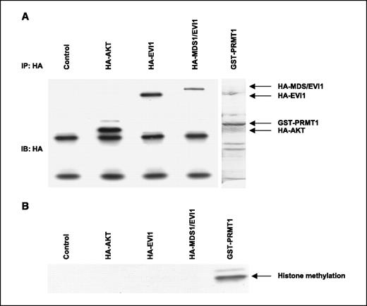 Figure 4. The PR domain of MDS1/EVI1 is negative for methyltransferase activity. A, transient transfection with HA-AKT, HA-EVI1, and HA-MDS1/EVI1 fusion constructs was done in COS7 cells. Immunoprecipitation with 12CA5 HA antibody was done 48 h post-transfection and verified by Western analysis using HA antibody. B, in vitro methyltransferase activity was assessed by incubation of free histones [H3, H4 (F3, F2a1), arginine-rich], purified GST-PRMT1 or HA-tagged proteins/complexes, and [3H]-S-adenosyl-l-methyl-methionine. We were unable to detect significant differences between a weak methyltransferase activity associated with MDS1/EVI1-HA immunoprecipitates and EVI1-HA immunoprecipitates. In contrast, GST-PRMT1, a type I protein arginine methyltransferase (46), dramatically increased the methylation of free histone substrates.