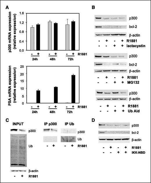 Figure 3. Mechanism underlying androgen-mediated down-regulation of p300 expression. A, no effects of androgens on p300 mRNA expression. LNCaP cells were seeded in CSS medium. Two days later, medium was changed and cells were treated with 1 nmol/L R1881 (black columns) or vehicle (gray columns) for the indicated periods of time. Total RNA was isolated and converted into cDNA. cDNA was amplified using p300 specific primers via real-time RT-PCR. p300 mRNA expression levels were normalized with the values obtained from glyceraldehyde-3-phosphate dehydrogenase expression. p300 mRNA levels are expressed as relative expression values, taking the average value obtained from cells at the 0 h time point as 1. Columns, means of representative experiment done in triplicate; bars, SE. B, involvement of the proteasome in the observed effects on p300 protein expression. Two days after being plated in CSS medium, LNCaP cells received fresh medium and were treated with 1 nmol/L R1881 or ethanol vehicle in the presence or absence of 10 μmol/L lactacystin, 1 μmol/L MG132, or 5 μmol/L ubiquitin aldehyde (Ub Ald). After 72 h, whole-cell lysates were prepared and p300 expression was evaluated by immunoblotting as described above. C, effect of androgens on ubiquitination of p300. LNCaP cells were seeded in medium supplemented with CSS. Three days later, cells were treated with 1 nmol/L R1881 or ethanol vehicle for 45 h. Cell lysates were subjected to immunoprecipitation with antibodies recognizing p300 or ubiquitin, and Western blotting was done as described before. D, effect of inhibition of NF-κB signaling on androgen-induced down-regulation of p300. Three days after being plated in CSS medium, LNCaP cells received fresh medium and were treated with 1 nmol/L R1881 or ethanol vehicle in the presence or absence of 100 μmol/L IKK-NBD for 72 h. Cells were harvested, and p300 expression was assessed as described above. As an additional control for the efficacy of MG132, lactacystin, and IKK-NBD, blots were stripped and reprobed with an antibody recognizing bcl-2. To evaluate potential loading differences, blots were stripped and reprobed with an antibody against β-actin (B–D).