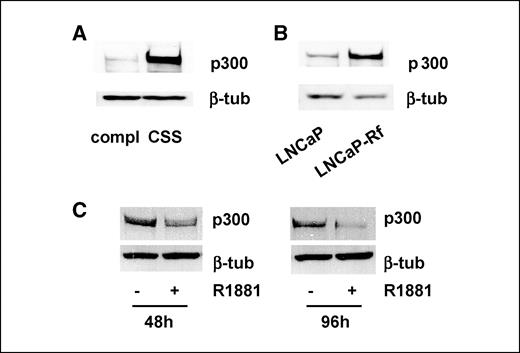 Figure 4. Effect of androgen-deprivation on p300 expression. A, effect of short-term androgen deprivation on p300 expression. LNCaP cells were seeded in complete (compl) or CSS medium. Three days later, total protein extracts were prepared and equal amounts of protein were analyzed by Western blotting with an antibody directed against p300. B, effect of long-term androgen deprivation on p300 expression. LNCaP and LNCaP-Rf cells were seeded in their regular medium. Three days later, cells were harvested and p300 expression was evaluated as described. C, effect of readministration of androgen on p300 expression in long-term androgen-deprived prostate cancer cells. LNCaP-Rf cells were seeded in their regular CSS medium. Two days later, medium was changed and cells were treated with R1881 (5 nmol/L) or ethanol vehicle. After 48 and 96 h, cells were harvested and p300 expression was analyzed by Western blot analysis. To evaluate potential loading differences, blots were stripped and reprobed with an antibody against β-tubulin (A–C).