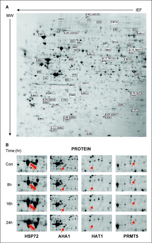 Figure 2. A, representative two-dimensional gel from A2780 human ovarian cancer cell control protein lysates. Proteins from cell lysates were separated according to both their molecular weight and their isoelectric point using two-dimensional electrophoresis. LM, landmark proteins that were used to align spots on gels. Annotated proteins responsive to 17AAG are indicated by gel spot number and are listed in Table 3. All gels were carried out in duplicate for each sample. B, selected regions of two-dimensional gels illustrating individual protein expression changes following 17AAG treatment. Protein expression of HSP72 AHA1, HAT-1, and PRMT5 across a 24-h time course following treatment with 17AAG.