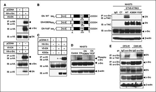 Figure 1. EN interacts with c-Src. A, V5-tagged EN was cotransfected into 293T cells with HA-tagged c-Src. Cell extracts were subjected to immunoprecipitation using anti-HA antibody or anti-V5 antibody and γ-bind beads (Amersham Pharmacia Biosciences), followed by immunoblotting with anti-V5 antibody or anti-HA antibody. The expression of EN and c-Src was monitored as indicated. B, schematic representation of ETV6-NTRK3 mutant constructs (top). c-Src does not associate with the kinase-dead EN-K380N and EN-Yx3F mutant protein. NIH3T3 cell lines stably expressing EN, EN-K380N, and EN-Y3XF as well as control NIH3T3 cells (MSCV) were used. Cell extracts were immunoprecipitated using anti-TrkC (NTRK3) antibody and γ-bind beads (Amersham Pharmacia Biosciences), followed by immunoblotting with anti-Src antibody. C, NTRK3 kinase activity is required for the EN interaction with c-Src. EN-expressing NIH3T3 cells or vector control cells were pretreated with K-252a for 2 h. Cell extracts were immunoprecipitated using anti-TrkC (NTRK3) antibody, followed by immunoblotting with anti-Src antibody. D, EN increased phosphorylation of c-Src in vivo. E, identification of EN–c-Src complexes in human primary tumors. Primary tumor tissue extracts from EN-positive CMN and CFS were subjected to immunoprecipitation using anti–cSrc antibody or IgG as a control, followed by immunoblotting with anti-TrkC (NTRK3) antibody. Whole-tissue lysates from primary tumors also were probed for EN, c-Src, phospho–c-Src, and β-actin as a loading control.