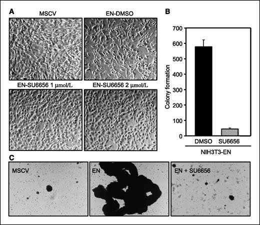 Figure 2. Inhibition of c-Src activation blocks soft agar colony formation of ETV6-NTRK3–expressing NIH3T3 cells. A, The NIH3T3 cell line stably expressing EN as well as control NIH3T3 cells (MSCV) were grown in medium containing 9% serum and were treated with various doses of SU6656, vehicle control (DMSO) for 12 h. Cells were then photographed in time at ×200 magnification. B, soft agar colony forming assay of NIH3T3 cells stably expressing EN. Monolayer cells were trypsinized, washed, and plated in medium containing 0.2% agar to assess anchorage-independent growth. Results are presented as the number of macroscopic colonies formed at 3 wks after plating. C, anchorage-independent spheroid growth of NIH3T3 cells stably expressing EN as well as control NIH3T3 cells.
