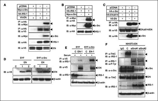 Figure 4. EN interacts with c-Src and IRS-1. A, V5 tagged EN was cotransfected into 293T cells with the HA-tagged IRS-1 and Myc-tagged c-Src constructs. Cell extracts were subjected to immunoprecipitation using anti-HA antibody and γ-bind beads (Amersham Pharmacia Biosciences), followed by immunoblotting with anti-TrkC(NTRK3) antibody or anti-V5 antibody. The expression of c-Src, IRS-1, or EN was monitored as indicated. B, HA-tagged IRS-1 was cotransfected into 293T cells with the Myc-tagged c-Src constructs. C, ENΔ614 associates with the c-Src protein. HA-tagged c-Src was cotransfected into 293T cells with V5-tagged EN or the EN mutant ENΔ614 construct. D, generation of SYF and SYF-Src cells stably expressing V5-tagged EN. Expression of EN protein was examined by immunoblotting in SYF and SYF-Src cells expressing V5-tagged EN. E, c-Src expression in c-Src–deficient MEF cells enhances the EN–IRS-1 complex formation. Cell extracts were subjected to immunoprecipitation using anti-V5 antibody and γ-bind beads (Amersham Pharmacia Biosciences), followed by immunoblotting with anti–IRS-1 antibody. The expression of V5-EN or IRS-1 was monitored as indicated. F, suppression of c-Src expression by stable siRNA decreases the level of IRS-1 bound to EN in NIH3T3 cells stably expressing EN. ETV6-NTRK3, c-Src–siRNA–expressing or control NIH3T3 cells were serum starved overnight in 0.5% serum and then stimulated with 9% calf serum–DMEM for 1 h. Cell extracts were subjected to immunoprecipitation using anti-V5 antibody or anti–IRS-1, followed by immunoblotting with anti–IRS-1 antibody or anti–phospho-tyrosine antibody. The expression of V5-EN or IRS-1 was monitored as indicated.