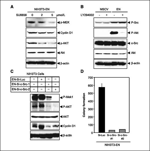 Figure 5. The SU6656 c-Src inhibitor, but not LY294002 Akt inhibitor, reduces the level of MEK phosphorylation, Akt phosphorylation, and cyclin D1 in ETV6-NTRK3–expressing NIH3T3 cells. A, MSCV or ETV6-NTRK3–transformed NIH3T3 cells were grown for 48 h in 9% calf serum–DMEM and then incubated with or without the c-Src family tyrosine kinase inhibitor SU6656 (2 and 5 μmol/L) or DMSO (0) for 1 h. Total cell lysates were prepared from the untreated and treated cells, and Western blotting was done using antibodies against P-MEK, P-Akt, and cyclin D1. B, MSCV or ETV6-NTRK3–expressing cells were grown for 48 h in 9% calf serum–DMEM and then grown in 9% calf serum–DMEM with or without LY294002 (25 μmol/L) for 1 h. Whole cell lysates were prepared, and Western blotting was done using phospho-Src and phospho-Akt antibody. C, suppression of c-Src expression by stable siRNA decreases elevated levels of phosphorylated Akt in NIH3T3 cells stably expressing ETV6-NTRK3. ETV6-NTRK3, c-Src–siRNA–expressing or control NIH3T3 cells were serum starved overnight in 0.5% serum and then stimulated with 9% CS-DMEM for 1 h. Whole cell lysates were prepared for Western blotting and probed with antibodies against the phosphorylated forms of Mek1/2 (Ser217/221), phosphorylated Akt (Ser473), and cyclin D1. D, soft agar colony-forming assay. Soft agar colony-forming assay of EN control-siRNA, EN c-Src–siRNA-1, and EN c-Src–siRNA-2. Monolayer cells were trypsinized, washed, and plated in medium containing 0.2% agar to assess anchorage-independent growth. Results are presented as the number of macroscopic colonies formed at 3 wks after plating.