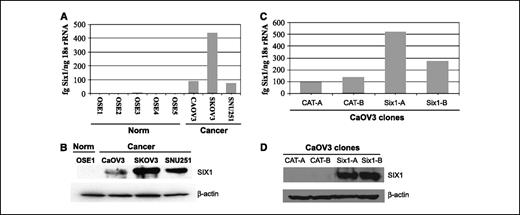 Figure 1. Six1 is overexpressed in ovarian carcinoma cell lines compared with normal ovarian surface epithelial cells. A, quantitative RT-PCR for Six1 in three OCC compared with five OSE cell lines. B, Western blots of nuclear extracts from the same cells as in (A) showing one representative OSE line (C) Overexpression of Six1 mRNA in CaOV3 cells transfected with Six1. Quantitative RT-PCR shows 2- to 5-fold overexpression of Six1 mRNA in CaOV3-Six1 transfectant clones compared with CaOV3-CAT controls. D, Western blot analysis of whole-cell lysates for SIX1 protein in CaOV3-Six1 clones. Note: no endogenous SIX1 protein can be observed in whole-cell lysates from CaOV3 cells although it can be observed in nuclear extracts from the same cell type (B).