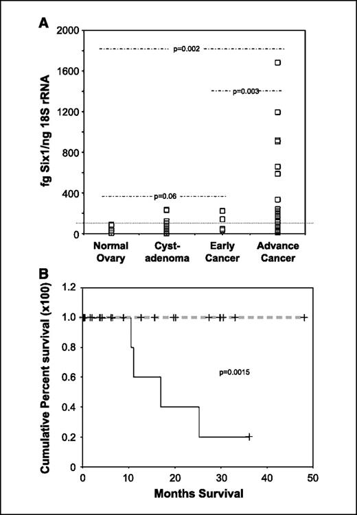 Figure 5. Six1 mRNA is overexpressed in ovarian carcinomas compared with normal ovary and is associated with poor prognosis in late-stage cancers. A, quantitative RT-PCR for Six1 in normal ovary (n = 5), cystadenoma (n = 13), early-stage (stage I) ovarian carcinomas (n = 6), and late-stage metastatic (stages II–IV) ovarian carcinomas (n = 27). Dotted line runs across graph at 100 fg Six1/ng rRNA. B, survival curves for patients with tumor Six1 levels >300 fg/ng rRNA (solid line) compared with Six1 levels <300 fg/ng rRNA (dashed line). Median follow-up of 11 months (log-rank, P = 0.0015).