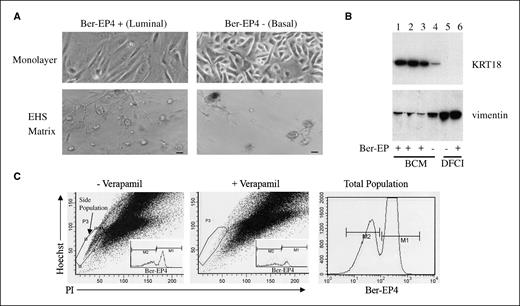 Figure 2. Properties of HMEC sorted by Ber-EP4 reactivity. A, HMEC were physically sorted based on cell surface staining with the Ber-EP4 antibody and placed into the appropriate selective medium; that is, cells with high-level reactivity (luminal cells) were placed into BCM and cells with low reactivity (basal cells) were placed into DFCI. Cells were then grown for 8 d in monolayer or three-dimensional cultures (in Matrigel constituted in DFCI) and imaged by phase contrast photomicroscopy. Bar, 50 μm. B, immunoblot of protein extracted from monolayer cultures of HMEC sorted by Ber-EP4 staining. Top blot, probed for KRT18; bottom blot, from the same protein extracts, probed with an antibody to vimentin. Lanes 1 to 3, Ber-EP4 positive cells (luminal) cultured in BCM; lane 4, Ber-EP4 negative (basal) cultured in BCM; lane 5, Ber-EP4 negative (basal) cultured in DFCI; lane 6, Ber-EP4 positive (luminal) cultured in DFCI. HGF (lane 1, 5 ng/mL) and prolactin (lane 2, 5 μg/mL) were added to the BCM. KRT18 migrated at 45 kDa and vimentin at 58 kDa. For subsequent experiments with luminal cells and BCM, HGF was added to all plates. C, analysis of side population in HMEC. Unfractionated primary HMEC were incubated with Hoechst 33342 for 75 min in the presence or absence of 50 μg/mL verapamil. The cells were then stained with the Ber-EP4 antibody and a secondary antibody conjugated with FITC. The cells were then incubated with propidium iodide (PI) and analyzed by flow cytometry. Gating of the side population was guided by the difference between verapamil-treated and untreated cells, and this population was then analyzed for Ber-EP4 intensity. Both Ber-EP4–positive and Ber-EP4–negative cells were equally diminished after verapamil treatment, indicating that the side population was evenly distributed between basal and luminal cells.