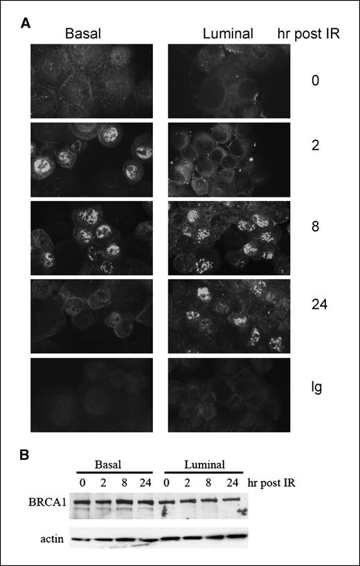 Figure 4. Kinetics of nuclear accumulation of BRCA1 protein after ionizing radiation in basal and luminal breast epithelial cells. A, cells were grown in monolayer culture, treated with 5 Gy of ionizing radiation, then harvested at the indicated time points and prepared for immunofluorescent detection using the monoclonal antibody, MS110. BRCA1 protein localized to intense nuclear foci in both cell types and in a large fraction of the cells during the course of the experiment. B, detection of total cellular BRCA1 protein by immunoblotting in basal and luminal cells treated with 5 Gy of ionizing radiation. Levels and mobility of the 220 kDa BRCA1 protein did not vary significantly over the course of the experiment or between the cell types.
