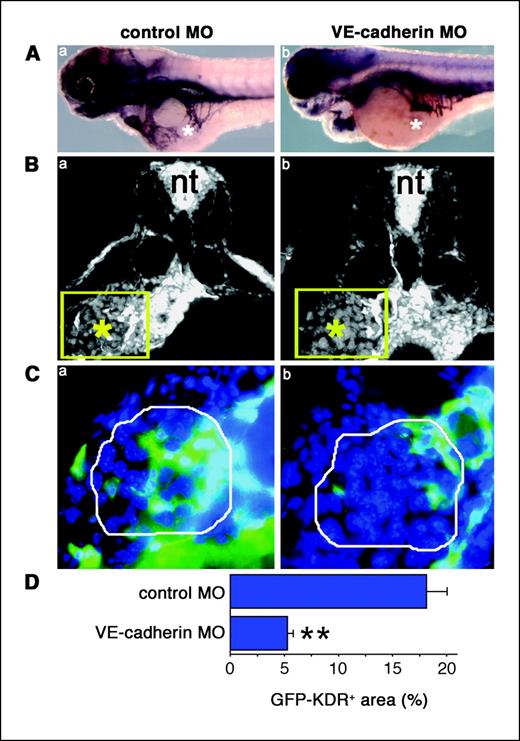 Figure 4. VE-cadherin MO inhibits tumor angiogenesis in zebrafish embryo. A, whole-mount alkaline-phosphatase staining of FGF2-T-MAE cell–grafted VEGFR2:G-RCFP control (a) and VE-cadherin (b) morphants at 72 hpf (lateral view). B, DAPI-stained transverse sections of tumor-injected control (a) and VE-cadherin (b) morphants [nt, neuronal tube; *, cell graft; green boxes, areas enlarged in (C); original magnification, ×200]. C, GFP-KDR+ neovessels (green) within the tumor graft (white line) in VEGFR2:G-RCFP control (a) and VE-cadherin (b) morphants (original magnification, ×600). D, quantification by computerized image analysis of the GFP-KDR+ area in tumors of control and VE-cadherin morphants (n = 8; P < 0.01).