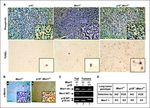 Figure 3. p18 deficiency protects loss of the wild-type Men1 allele. A, sections of lung tumors from different genotypes of mice were examined for cell proliferation by immunostaining with an antibody recognizing phosphorylated histone H3 and for apoptotic cell death by TUNEL assay. Positive stainings are in brown and counterstainings are in blue. Insets, magnified images. B, sections of lung tumors (×100; inset, ×400) were immunostained with an antibody against menin. Note the strong menin staining in the tumors from p18−/−;Men1+/− mice and background staining in the tumors from Men1+/− mice. C, DNA extracted from the microdissected tumors of different genotypes was amplified by PCR to detect wild-type and mutant (mt) alleles of Men1 and p18, respectively. D, summary of loss of menin expression and of wild-type Men1 allele in lung tumors.
