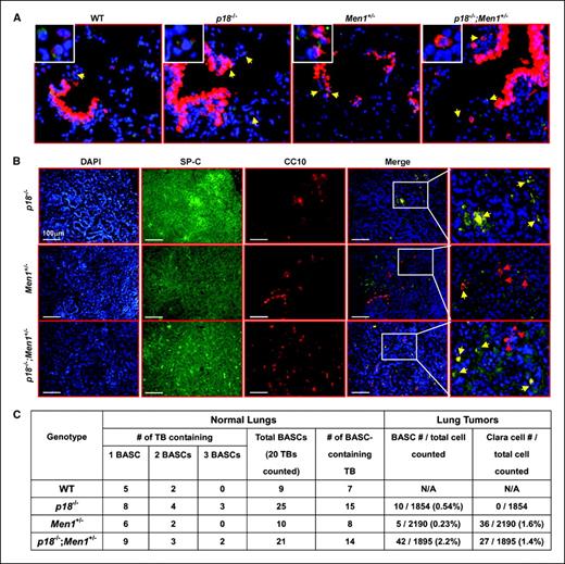 Figure 5. p18 deficiency expands putative BASC population in lung tumors. A and B, normal lung sections from 3-mo-old mice (A) and tumor sections from age-matched mice (B) were immunostained with antibodies against CC10 (red) and SP-C (green) and with 4′,6-diamidino-2-phenylindole (DAPI; blue). Yellow arrows, CC10/SP-C double-positive BASCs; red arrows, CC10 single-positive Clara cells. C, summary of quantification of BASC and Clara cells from lung tumors and normal lungs.