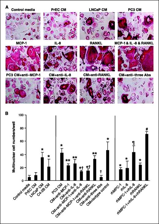 Figure 4. Neutralizing antibodies for MCP-1 diminished the prostate cancer conditioned medium (CM)–induced osteoclast formation. Nonadherent HBMC was cultured at 1 × 105 per well in 96-well plates for 3 wks. HBMC cultures were all incubated with rhM-CSF (10 ng/mL) and indicated treatment of rhMCP-1 (10 ng/mL), rhIL-8 (10 ng/mL), rhRANKL (50 ng/mL), or 10% conditioned medium from PC3 cells with or without MCP-1 neutralizing antibody at 1 μg/mL or IL-8 neutralizing antibody at 200 ng/mL or RANKL neutralizing antibody at 1 μg/mL. After 3 wks, the human osteoclast-like cells were identified by monoclonal antibody 23c6. The positive staining cells that contained three or more nuclei were scored as osteoclast-like multinucleated cells. A, representative micrographs of HBMC cultures stained for monoclonal antibody 23c6. B, a number of osteoclast-like multinucleated cells per well were quantified. Samples were evaluated in quadruplicate. Columns, mean; bars, SD. Data were analyzed using one-way ANOVA. *, P < 0.001, compared with control medium–treated group; **, P < 0.01, compared with PC3 conditioned medium–treated group; †, P < 0.001, compared with PC3 conditioned medium–treated group; ¶, P < 0.005, compared with rhMCP-1–treated group; #, P < 0.0001, compared with rhMCP-1–treated group. C, representative micrographs of RAW cell cultures stained for TRAP. D, a number of osteoclast-like multinucleated cells per well were quantified. *, P < 0.001, compared with control medium–treated group; **, P < 0.01, compared with PC3 conditioned medium–treated group; †, P < 0.001, compared with PC3 conditioned medium–treated group; #, P < 0.001, compared with rhMCP-1–treated group.