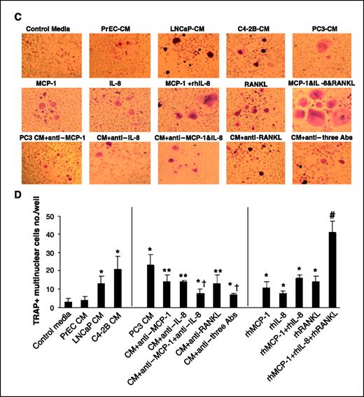 Figure 4. Neutralizing antibodies for MCP-1 diminished the prostate cancer conditioned medium (CM)–induced osteoclast formation. Nonadherent HBMC was cultured at 1 × 105 per well in 96-well plates for 3 wks. HBMC cultures were all incubated with rhM-CSF (10 ng/mL) and indicated treatment of rhMCP-1 (10 ng/mL), rhIL-8 (10 ng/mL), rhRANKL (50 ng/mL), or 10% conditioned medium from PC3 cells with or without MCP-1 neutralizing antibody at 1 μg/mL or IL-8 neutralizing antibody at 200 ng/mL or RANKL neutralizing antibody at 1 μg/mL. After 3 wks, the human osteoclast-like cells were identified by monoclonal antibody 23c6. The positive staining cells that contained three or more nuclei were scored as osteoclast-like multinucleated cells. A, representative micrographs of HBMC cultures stained for monoclonal antibody 23c6. B, a number of osteoclast-like multinucleated cells per well were quantified. Samples were evaluated in quadruplicate. Columns, mean; bars, SD. Data were analyzed using one-way ANOVA. *, P < 0.001, compared with control medium–treated group; **, P < 0.01, compared with PC3 conditioned medium–treated group; †, P < 0.001, compared with PC3 conditioned medium–treated group; ¶, P < 0.005, compared with rhMCP-1–treated group; #, P < 0.0001, compared with rhMCP-1–treated group. C, representative micrographs of RAW cell cultures stained for TRAP. D, a number of osteoclast-like multinucleated cells per well were quantified. *, P < 0.001, compared with control medium–treated group; **, P < 0.01, compared with PC3 conditioned medium–treated group; †, P < 0.001, compared with PC3 conditioned medium–treated group; #, P < 0.001, compared with rhMCP-1–treated group.
