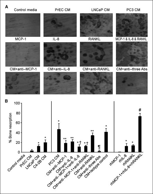 Figure 5. Neutralizing antibodies for MCP-1 and IL-8 synergistically diminished the prostate cancer conditioned medium–induced bone resorption. HBMCs at 1 × 105 per well were seeded on the dentin slices in 96-well plate and treated as in Fig. 4. After 3 wks, the dentin slices were stained with TRAP staining kit and then the cells on the dentin slices were then removed by rubbing the slices, and area of resorption was determined microscopically with SPOT software. A, representative images of resorption pits on dentin slices. B, samples were evaluated in triplicates. Columns, mean; bars, SD. *, P < 0.001, compared with control medium–treated group; **, P < 0.005, compared with PC3 conditioned medium–treated group; †, P < 0.01, compared with PC3 conditioned medium–treated group plus anti-MCP-1–treated group; ¶, P < 0.001, compared with PC3 conditioned medium–treated group; #, P < 0.001, compared with either rhIL-8–treated or rhRANKL-treated groups.