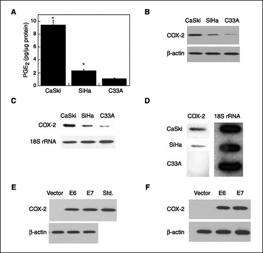 Figure 1. HPV16 E6 and E7 oncoproteins induce COX-2 transcription. A, CaSki, SiHa, and C33A cells were grown in culture medium for 6 h. This medium was then replaced with fresh medium containing 10 μmol/L sodium arachidonate. Thirty minutes later, the medium was collected to determine amounts of PGE2. Production of PGE2 was determined by enzyme immunoassay. Columns, mean (n = 6); bars, SD. *, P < 0.001, compared with C33A cells. B, cellular lysate protein (500 μg) was used to immunoprecipitate COX-2 or β-actin from the cells as described in Materials and Methods. Immunoprecipitates were then loaded on a 10% SDS-polyacrylamide gel, electrophoresed, and subsequently transferred onto nitrocellulose. The immunoblot was probed with antibodies specific for COX-2 or β-actin. C, total cellular RNA was isolated from CaSki, SiHa, and C33A cells. RNA (10 μg) was added to each lane. The blot was hybridized with probes that recognized COX-2 mRNA and 18S rRNA. D, nuclei were isolated from CaSki, SiHa, and C33A cells. The COX-2 and 18S rRNA cDNAs were immobilized onto nitrocellulose membranes and hybridized with labeled nascent RNA transcripts. E and F, COX-2 expression was analyzed in C33A (E) or HEK293 (F) cells stably expressing vector alone or HPV E6 or E7. Cell lysate protein (100 μg) was subjected to 10% SDS-polyacrylamide gel, electrophoresed, and subsequently transferred onto nitrocellulose. The immunoblot was probed with antibodies specific for COX-2 or β-actin.