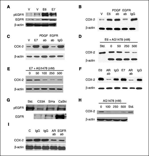 Figure 2. HPV16 E6- and E7-mediated induction of COX-2 is dependent on EGFR activation. A, C33A cells were stably transfected with empty vector (V), HPV16 E6 (E6), or HPV16 E7 (E7). Cell lysate protein (500 μg) was subjected to immunoprecipitation with antibodies to phosphotyrosine, EGFR, or β-actin. The immunoprecipitates were then subjected to Western blotting. The blots were probed with antibodies to phosphorylated EGFR (pEGFR), EGFR, and β-actin. B and C, C33A cells stably transfected with empty vector, HPV E6 (B), or HPV E7 (C) were grown in medium with or without the indicated antibody (ab) treatment for 12 h. D and E, C33A cells stably transfected with HPV E6 (D) or HPV E7 (E) were treated with 0 to 500 nmol/L of AG1478 for 12 h. F, C33A cells stably transfected with HPV E6 or HPV E7 were grown in medium with antibody to amphiregulin (AR) or IgG for 12 h. B to F, cell lysate protein (100 μg) was subjected to 10% SDS-polyacrylamide gel, electrophoresed, and subsequently transferred onto nitrocellulose. The immunoblots were sequentially probed with antibodies specific for COX-2 or β-actin. G, levels of phosphorylated EGFR and EGFR were compared in CaSki, SiHa, and C33A cells. Immunoblot analysis was carried out as described above. H, CaSki cells were treated with 0 to 500 nmol/L of AG1478 for 12 h. Subsequently, cell lysate protein (500 μg) was subjected to immunoprecipitation with antibodies to COX-2 or β-actin and the immunoprecipitates were subjected to Western blotting. I, CaSki cells were grown in medium with or without the indicated antibodies for 12 h. Subsequently, analysis was carried out as in (H).