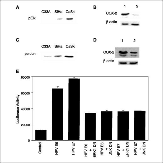 Figure 3. ERK1/2 and JNK activities are important for HPV16 E6- and E7-mediated induction of COX-2 expression. The activities of ERK1/2 (A) and JNK (C) were measured. B, CaSki cells were treated with vehicle (lane 1) or 100 μmol/L PD 98059 (lane 2) for 8 h. D, CaSki cells were treated with vehicle (lane 1) or 1 μmol/L SP 600125 (lane 2) for 8 h. B and D, following the indicated treatments, 500 μg of cell lysate protein were immunoprecipitated with antibodies to COX-2 or β-actin. The immunoprecipitates were then loaded onto a 10% SDS-polyacrylamide gel, electrophoresed, and subsequently transferred onto nitrocellulose. Immunoblots were probed separately for COX-2 and β-actin. E, C33A cells were transfected with 0.9 μg of a human COX-2 5′-untranslated region construct ligated to luciferase (−327/+59) and 0.2 μg of pSVβgal. HPV E6 and HPV E7, cells that received 0.45 μg of expression vector for HPV16 E6 or E7, respectively. HPV E6 + ERK1 DN and HPV E6 + JNK DN, cells that received 0.45 μg of expression vectors for HPV16 E6 and ERK1 or JNK dominant-negative forms, respectively. HPV E7 + ERK1 DN and HPV E7 + JNK DN, cells that received 0.45 μg of expression vectors for HPV16 E7 and ERK1 or JNK dominant negatives, respectively. The total amount of DNA in each reaction was kept constant at 2 μg by using corresponding empty expression vector. Twenty-four hours after transfection, the cells were lysed and reporter activities were measured. Luciferase activity represents data that have been normalized to β-galactosidase activity. Columns, mean (n = 6); bars, SD.