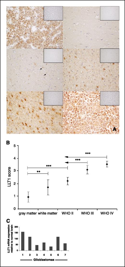 Figure 2. Human gliomas express LLT1 in vivo. A, paraffin-embedded tissue sections of normal human brain gray and white matter, gliomas of different grades of malignancy, and human plasmacytoma were stained with mAb 4C7 or isotype control antibody. While the IgG control did not result in any labeling on tissue sections (insets), both membrane and cytoplasmic staining patterns were observed in WHO grade II (middle right), III (bottom left) and IV (bottom right) gliomas. Only low LLT1 immunoreactivity was detected in the gray (top right) and white (middle left) matter of normal human brain, whereas human plasmacytoma, used as a positive control, showed intense labeling (top left). Original magnification, ×400. B, LLT1 expression levels in normal human brain gray and white matter and gliomas of different grades of malignancy were quantified. Scoring was based on the percentage of positive cells (see Materials and Methods). C, LLT1 mRNA expression levels of fresh glioblastoma tissue were analyzed by real-time PCR (one representative of three independent experiments is shown).