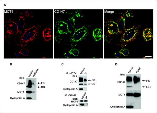 Figure 2. MCT4 and CD147 colocalize to the cell surface of MDA-MB-231 cells where they form MCT4/CD147 complexes. A, CD147 and MCT4 colocalize in the plasma membrane and in membrane blebs. MDA-MB-231 cells were immunolabeled with anti-MCT4 (red) and anti-CD147 (green) antibodies and imaged by confocal laser scanning microscopy. TO-PRO-3 iodide (blue) was used to label nuclei. Note the extensive blebbing at the surface of these cells and the colocalization of these proteins (Merge, yellow). Bar, 20 μm. B, MCT4 and fully glycosylated CD147 are expressed in membrane vesicles. Immunoblot analysis of membrane vesicles isolated from conditioned medium of MDA-MB-231 cells. Vesicles were analyzed by immunoblot using antibodies against CD147, MCT4, and cyclophilin A (as an internal control). Total protein (5 μg) was loaded in Lysate lane. Pellet fraction (25 μL) was loaded into the Vesicles lane. C, CD147 and MCT4 form a complex in MDA-MB-231 cells. Detergent-soluble lysates were immunoprecipitated with anti-CD147 or anti-MCT4. Soluble and pellet fractions were analyzed by immunoblot using antibodies against CD147, MCT4, and cyclophilin A (as an internal control). D, both MCT4 and fully glycosylated CD147 are expressed at the cell surface of MDA-MB-231 cells. After streptavidin-agarose precipitation, samples were analyzed by immunoblot using antibodies against CD147, MCT4, and cyclophilin A (as an internal control). Total protein (5 μg) was loaded in Lysate lanes in (C) and (D); pellet fraction (25 μL) was loaded in the IP lane (C) and Pellet lane (D). IP, immunoprecipitate.