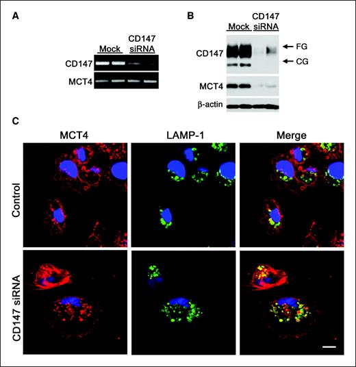 Figure 5. Silencing of CD147 in MDA-MB-231 cells leads to intracellular accumulation and decreased expression of MCT4. A, CD147 siRNA effectively decreases levels of CD147 mRNA without affecting MCT4 mRNA levels. Duplicate samples for each condition. B, CD147 siRNA leads to reduction of both MCT4 and CD147 protein expression levels in MDA-MB-231 cells. Immunoblots of cell lysates were probed with antibodies against CD147, MCT4, and β-actin (as an internal control). Total protein (5 μg) was loaded in each lane. Duplicate samples of each condition. C, treatment of MDA-MB-231 cells with CD147 siRNA results in the accumulation of MCT4 in the endolysosomal compartment. Cells were immunolabeled with MCT4 (red) and LAMP-1 (green) antibodies and imaged by confocal laser scanning microscopy. TO-PRO-3 iodide (blue) was used to label nuclei. Top, localization of MCT4 and LAMP-1 in cells transfected with control siRNA; bottom, localization of these proteins in cells transfected with CD147 siRNA. Bar, 20 μm.