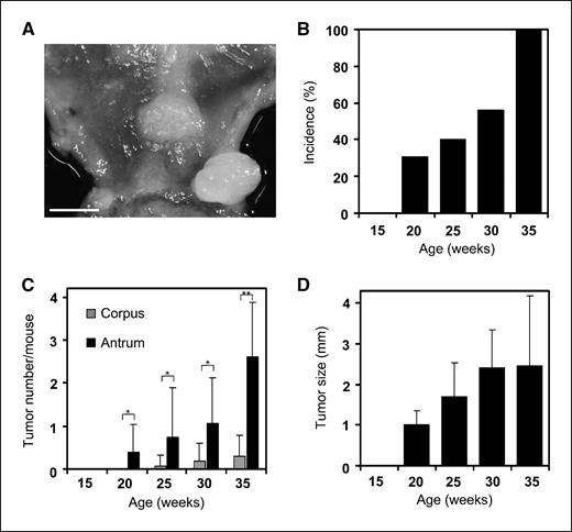Figure 1. The spontaneous development of gastric tumors in aged ApcMin/+ mice. A, macroscopic photograph of the grandular stomach of an ApcMin/+ mouse at 30 weeks of age. Bar, 2 mm. B, incidence of ApcMin/+ mice with gastric tumors increased by aging. C, number of gastric tumors increased by aging and gastric tumors preferentially developed in the antrum. Columns, mean; bars, SD. *, P < 0.05, Mann-Whitney U test; **, P < 0.01, Mann-Whitney U test. D, the size (the maximum long diameter) of gastric tumors in ApcMin/+ mice increased over time. Columns, mean; bars, SD.