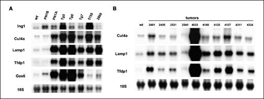 Figure 1. A, Northern blot analysis of deregulated genes in two p53 null mammary epithelial outgrowth lines: PN1B, mildly aggressive low tumorigenic; PN1A, highly aggressive and tumorigenic, and five mammary tumors derived from the PN1A outgrowth line (Tg5, Tg6, Tg7, 5155, and 2860). Lane wt, p53 wild-type normal mammary epithelium. B, Northern blot analysis of Cul4a, Lamp1, and Tfdp1 in spontaneously generated p53 null mammary tumors (lanes 2–11) compared with p53 wild-type normal mammary epithelium (lane 1).