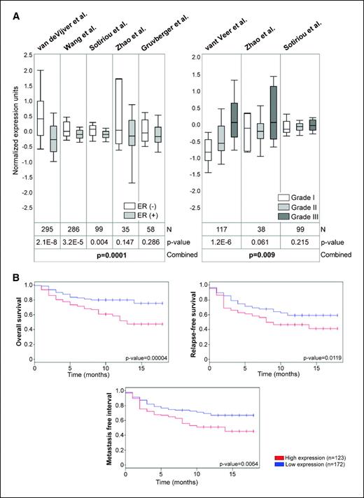 Figure 5. TFDP1 expression profile of human breast carcinoma using publicly available DNA microarray data sets. A, oncomine data output and meta-analysis showing TFDP1 expression patterns positively associated with ERα(−) breast carcinoma (left). Oncomine data output of TFDP1 expression patterns correlated with high-grade breast carcinoma (right). TFDP1 transcripts are represented in normalized expression units (log 2 data transformed, array media set to 0 and array SD to 1). B, Kaplan-Meier curves of overall survival, relapse-free survival, and metastasis-free interval based on high or low expression levels of TFDP1 gene. Kaplan-Meier analysis was assessed using the Van de Vijver et al. (10) data set by means of ITTACA online resources.