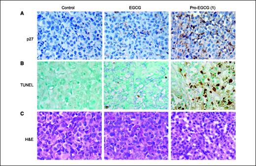 Figure 4. Immunohistochemistry with p27 antibody (A), TUNEL assay (B), and H&E staining (C) using mouse tumor samples (prepared from the same experiment in Fig. 3).