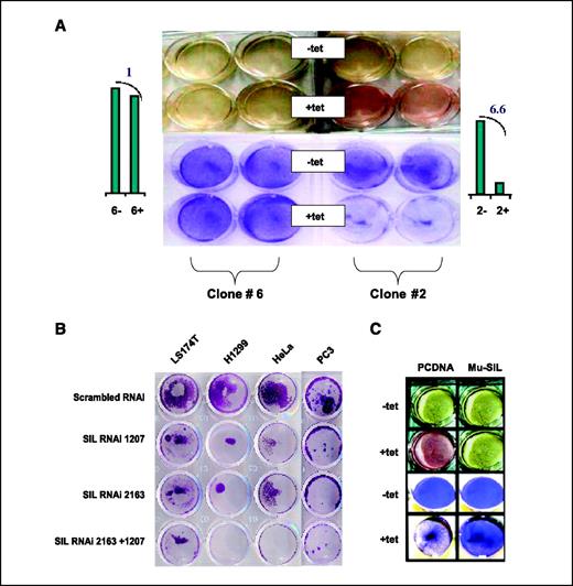 Figure 1. RNAi-mediated knockdown of SIL results in a lower number of living cells. A, differences in cell growth before (−Tet) and after (+Tet) the addition of tetracycline. Right, clone no. 2, in which SIL is down-regulated six times more than in clone no. 6 (columns). Similar results were seen with additional clones (data not shown). The difference in growth is shown by the change of the color of natural medium in the plate containing more cells and by the complementary crystal violet staining. B, the effect of SIL knockdown on the growth of several cancer cell lines transfected with two different siRNA oligonucleotides for SIL (oligos 1207 and 2163, see Supplementary Table S2). As a control, a scrambled RNAi was used. H1299 (non–small cell lung cancer, carcinoma), HeLa (cervical adenocarcinoma), PC3 (prostate adenocarcinoma), and LS174T (colon carcinoma) were used. Similar results were observed with additional cell lines: MCF-7 (breast adenocarcinoma), PANC1 (pancreatic carcinoma), U-87 (glioblastoma), and Caki-2 (kidney carcinoma). C, murine Sil rescues the human SIL knockdown: natural medium and crystal violet staining of clone no. 2 posttransfection with either pcDNA3 or murine SIL with or without tetracycline exposure.