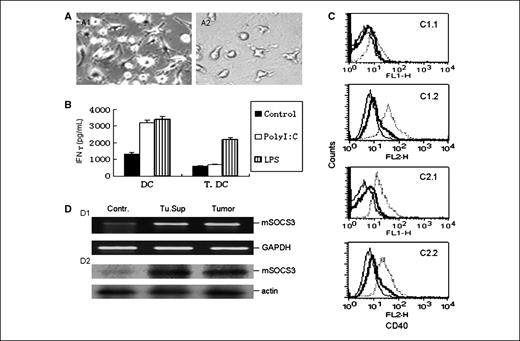 Figure 1. Murine BMDCs reveal the reduced TLR3 signaling and elevated SOCS3 on exposure to model ovarian cancer. A, representative phase-contrast micrograph depicting morphologic changes in BMDCs cocultured with ovarian tumor 1D8 cells for 4 d. A1, control BMDCs; A2, BMDCs cocultured with ovarian tumor 1D8 cells. B, polyI:C did not effectively improve the function of tumor-associated BMDCs. Ovarian tumor–associated DCs (T. DC) and control BMDCs (DC) were treated with polyI:C or LPS and then used as stimulator after loading VLPs to induce the production of IFNγ by HPV16 L1 VLP-specific spleen cells (18). Splenocytes were from mice immunized with VLPs (16). VLP-specific splenocytes (2 × 106) were stimulated by DC or tumor-associated DC (Control), polyI:C-treated DC or tumor-associated DC (PolyI:C), or LPS-treated DC or tumor-associated DC (LPS) after loading VLPs. The ratio of DC to VLP-specific splenocytes was 1:20. Generation of tumor-associated DCs and DC was described in Materials and Methods. C, surface expression of CD40 by tumor-associated DCs (C1.1 and C1.2) and control DCs (C2.1 and C2.2) after exposure to polyI:C (C1.1 and C2.1) and LPS (C1.2 and C2.2) for 48 h. Thin line, isotypic control; thick line, unstimulated; dotted lines, stimulated. D, ovarian tumor–associated DCs express higher levels of SOCS3. D1, expression of SOCS3 and GAPDH transcripts in BMDCs determined by RT-PCR; D2, protein levels of SOCS3 and actin were determined by Western blot analysis; BMDCs cocultured with tumor cells were sorted by staining with FITC-labeled anti-CD80 antibody and flow cytometry. Contr., untreated BMDCs; Tu.Sup, BMDCs cultured with 25% (v/v) 1D8 tumor cell–conditioned medium for 48 h; Tumor, BMDCs cocultured with 1D8 tumor cells (ratio of tumor cells to BMDCs was 1:5) for 48 h.