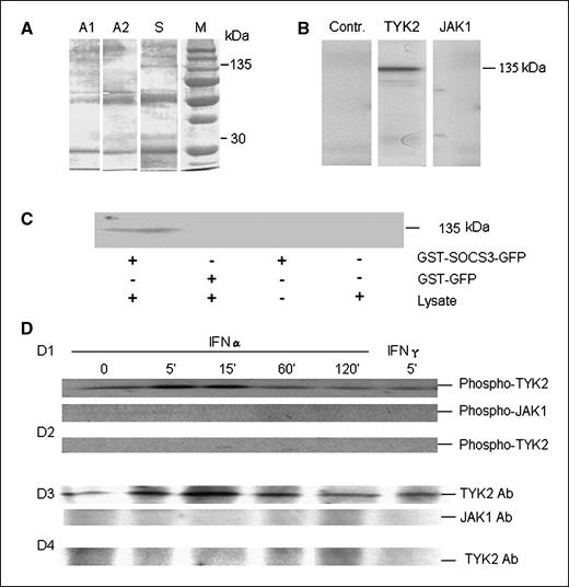 Figure 5. The role of type I IFNR TYK2 in the inhibition of SOCS3 on expression of CD40. A, silver stain analysis of immunoprecipitates from lysates of pcDNA3.1TOPOHis/V5-transfected RAW264.7 cells (A1) and from pcDNA3.1SOCS3 TOPOHis/V5-transfected RAW264.7 cells (S). A2, isotypic antibody control; M, protein marker. B, Western blotting analysis of immunoprecipitation using anti-TYK2 (TYK2) and anti-JAK1 (JAK1) antibody. Contr., anti-V5 isotypic antibody control. C, pull-down analysis of binding of TYK2 to SOCS3. DC lysate in ice-cold buffer A was clarified by centrifugation at 16,000 × g for 30 min and passed over glutathione-Sepharose precoated with GST-GFP fusion protein either alone or fused to SOCS3; after extensive washing, the bound proteins were eluted with 50 mmol/L Tris-HCl and 10 mmol/L reduced glutathione (pH 8.0) and analyzed by Western blotting with anti-TYK2 antibody. D, IFNα promoted the binding of phospho-TYK2 (D1) and TYK2 (D3) to SOCS3. Cells were stimulated with 100 units/mL IFNα and 1,000 units/mL IFNγ. Cellular lysates were prepared at the different time points and then passed over glutathione-Sepharose precoated with GST-GFP fusion protein either alone or fused to SOCS3; after extensive washing, the bound proteins were eluted with 50 mmol/L Tris-HCl and 10 mmol/L reduced glutathione (pH 8.0) and analyzed by Western blotting with phospho-TYK2 (Tyr1054/1055) and phospho-JAK1 (Tyr1022/1023) antibody and anti-TYK2 or JAK1 antibody. D1 and D3, GST-SOCS3-GFP pull down; D2 and D4, GST-GFP pull down.