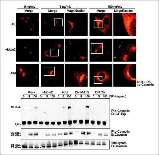Figure 5. Mediation of the caveolin internalization pathway. A, HEK293 cells were transfected with empty vector (mock), Mdm2, or c-Cbl. The cells were serum starved and stimulated with IGF-I (0, 5, or 100 ng/mL) for 10 min. The cells were fixed and stained with both anti–phospho-caveolin-1 and anti–IGF-IR antibodies. Immunofluorescence confocal microscopy was done. Columns 3 and 5, magnified fields indicated by squares in columns 2 and 4, respectively. B, HEK293 cells were transfected either with empty vector (mock) or with wt or DN forms of Mdm2 or c-Cbl. The cells were serum starved and stimulated as in A. After immunoprecipitation of phospho-caveolin, the samples were analyzed for IGF-IR and caveolin by Western blot. Caveolin from total lysate was used as a loading control. The experiments were repeated with similar results.