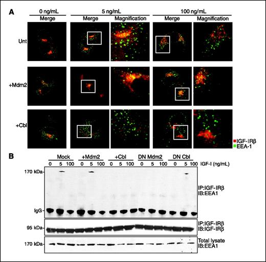 Figure 6. Mediation of the clathrin internalization pathway. A, HEK293 cells were transfected with empty vector (mock), Mdm2, or c-Cbl. The cells were serum starved and stimulated with IGF-I (0, 5, or 100 ng/mL) for 10 min. The cells were fixed and stained with anti–EEA-1 and anti–IGF-IR antibodies. Immunofluorescence confocal microscopy was done. Columns 3 and 5, magnified fields indicated by squares in columns 2 and 4, respectively. B, HEK293 cells were treated as described in Fig. 5B. After immunoprecipitation of IGF-IR, the samples were analyzed for EEA-1 and IGF-IR by Western blot. EEA-1 was used as a loading control. The experiments were repeated with similar results.