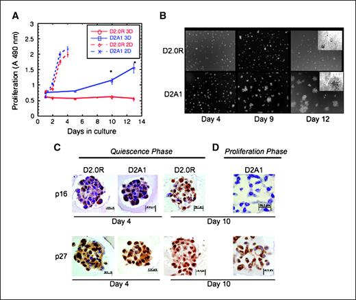 Figure 1. In vitro model for solitary tumor cell dormancy. A, proliferation of D2.0R and D2A1 in two-dimensional culture and in three-dimensional Cultrex (as described in Materials and Methods). Points, mean (n = 8); bars, SE. Representative result of three experiments. *, P ≤ 0.05. B, D2.0R and D2A1 cells were cultured in three-dimensional Cultrex (as described in Materials and Methods). Images of the cells were acquired at days 4, 9, and 12. Magnification, ×20. Top right, magnification, ×40. C and D, quiescence in the three dimensional culture is associated with elevated p16 and p27. Immunohistochemical staining for p16 and p27. C, quiescent phase: D2.0R cells, culture days 4 and 10; D2A1 cells, day 4. D, proliferative phase of D2A1 cells, day 10. Note loss of p16 expression and reduction of p27 nuclear localization during D2A1 proliferative phase, but continued high expression in quiescent D2.0R cells. Magnification, ×40.