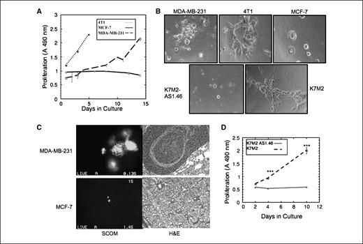 Figure 2. Correlation of in vivo dormant or metastatic behavior of tumor cells with growth in three-dimensional culture. A, proliferation of MDA-MB-231, 4T1, and MCF-7 cells in three-dimensional Cultrex. Points, mean (n = 8); bars, SE. Representative result of three experiments. B, morphology of MDA-MB-231, 4T1, MCF-7, K7M2AS1.46, and K7M2 cells cultured in three-dimensional Cultrex. Magnification, ×40. C, representative lungs from a mouse injected with GFP-expressing MDA-MB-231 (2 wk after injection) or MCF-7 cells (9 wk after injection). Left, SCOM images of MDA-MB-231 lung metastasis and dormant MCF-7 cell. Magnification, ×100. Right, representative H&E staining of MDA-MB-231 lung metastasis and of lung with MCF-7 cells lacking proliferative metastases. Magnification, ×20. D, proliferation of K7M2 and K7M2AS1.46 cells in three-dimensional Cultrex. Points, mean (n = 8); bars, SE. Representative result of three experiments. ***, P ≤ 0.001.