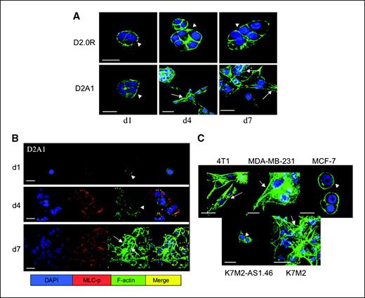 Figure 3. Actin stress fiber formation associated with MLC phosphorylation occurs during the transition from quiescence to growth in three-dimensional culture. D2.0R, D2A1, MCF-7, MDA-MB-231, 4T1, K7M2, and K7M2AS1.46 cells were cultured in three-dimensional Cultrex on glass coverslips (as described in Materials and Methods). Cells were fixed and stained with DAPI (blue) for nuclear localization, phalloidin (green) for F-actin, and an antibody against the phosphorylated form of MLC (red), as indicated at various time points, using confocal microscopy (magnification, ×63). A, proliferative growth is associated with actin stress fiber formation. Arrowheads, cortical F-actin staining was evident in D2.0R cells at day 1 (d1), day 4 (d4), and day 7 (d7). D2A1 cells exhibited cortical F-actin at day 1 (arrowhead), but actin stress fibers form at days 4 and 7 (arrows). B, actin stress fiber formation and proliferative growth is associated with MLC phosphorylation. D2A1 cells show localization of phosphorylated MLC with actin at day 1 (d1) and with actin stress fibers by day 7 (d7). C, 4T1 and MDA-MB-231 (day 4) and K7M2 cells (day 6) displayed actin stress fibers (arrows), whereas nonproliferative MCF-7 (day 14) and K7M2AS1.46 (day 10) displayed cortical F-actin staining (arrowheads). Scale bars, 20 μm.
