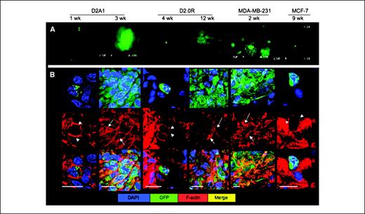 Figure 4. Cytoskeletal reorganization and formation of actin stress fibers during the switch from dormancy to metastatic growth. A, SCOM images (magnification, ×100) of lungs from mice injected with either D2A1-GFP (removed 1 or 3 wk after injection), D2.0R-GFP (removed 4 or 12 wk after injection), MDA-MB-231-GFP (removed 2 wk after injection), or MCF-7-GFP cells (removed 9 wk after injection). Time points varied according to the growth properties of the cells. B, frozen sections of lungs from mice injected with the above cells at the indicated time points stained for F-actin (red) using confocal microscopy. Scale bar, 20 μm. White arrowheads, cortical actin staining; white arrows, F-actin stress fibers.