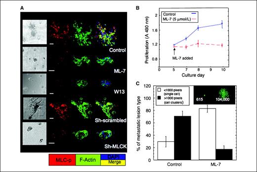 Figure 5. Inhibition of MLCK-mediated actin stress fiber formation blocks proliferation of metastatic cells in three-dimensional culture and reduces metastatic outgrowth in mice. A, D2A1 cells were cultured in three-dimensional Cultrex on glass coverslips. Cells were untreated (control) or treated with ML-7 (5 μmol/L) or W13 (5 μmol/L) for 48 h beginning on culture day 5 or treated with scrambled or MLCK shRNA as described in Materials and Methods and stained for the phosphorylated form of MLC (red), F-actin (green), and nuclei (blue). Merge of F-actin and phosphorylated MLC (MLC-p) staining (yellow) using light and confocal microscopy. Magnifications, ×40 and ×63, respectively. Scale bars, 20 μm. B, time course of D2A1 cell proliferation in three-dimensional Cultrex in the presence or absence of ML-7 (5 μmol/L). Points, mean (n = 8); bars, SE. C, inhibition of the metastatic outgrowth in lungs of mice treated with ML-7. Data presented as the percentage of single cells versus proliferative metastatic lesions in mice that received either ML-7 (22 mmol/L) or vehicle (control group; P ≤ 0.0001 across all samples; n = 9). Single cells (<1,000 pixel intensity) and clusters of cells (>1,000 pixel intensity), as depicted in top right panel.