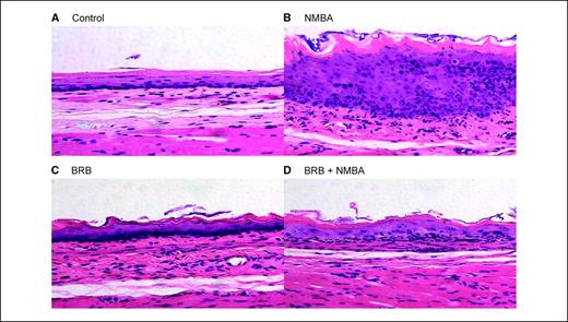 Figure 1. Effect of BRB on NMBA-induced preneoplastic lesions in rat esophagus. Microscopic esophageal tissue sections (magnification, ×100) stained with H&E. A, vehicle control esophagus. B, NMBA-treated esophagus (note extensive cytotoxicity and inflammatory response). C, BRB-treated esophagus. D, BRB+NMBA–treated esophagus.