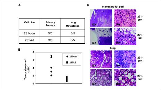Figure 6. Reduction in TβRIII in MDA-231 cells impairs tumorigenicity in vivo and reduces lung metastases. Cells (1 × 106) were resuspended in PBS and injected into the #4 right inguinal fat pad of athymic nude mice (n = 5 per group) and allowed to grow for 8 wk. Tumors were harvested, fixed in formalin, and embedded in paraffin followed by staining with H&E. A, number of mice that developed tumors and lung metastases. B, tumor volume in mm3 was calculated according to the formula: volume = width2 × length / 2. C, representative low-power and high-power H&E-stained, 5-μm tissue sections depicting representative mammary gland tumors and lung sections from mice injected with the indicated cells.
