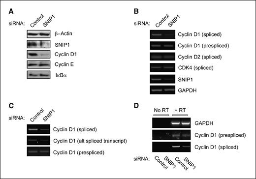 Figure 1. SNIP1 regulates Cyclin D1 RNA processing. A, Cyclin D1 protein expression is SNIP1 dependent. Protein extracts were prepared from U-2 OS cells treated with SNIP1 and control siRNAs. SDS-PAGE and Western blot analyses were performed using antibodies directed against Cyclin D1, Cyclin E, SNIP1, IκBα, and β-actin. B to D, SNIP1 is required for the production of mature Cyclin D1 mRNA. U-2 OS cells were treated with a SNIP1 siRNA. The relative levels of prespliced and postspliced RNAs were then assessed by semiquantitative PCR. The prespliced transcript is detected using primers within intron 1 and the postspliced transcript detected using primers situated within exons 3 and 5. The same results are also seen with primers directed to different regions of Cyclin D1 RNA (e.g., within intron 3 for prespliced message, or within exons 1 and 3 or 1 and 5 for postspliced message). Also shown are the levels of Cyclin D2 and CDK4 mRNAs. C, analysis included the alternately spliced Cyclin D1 transcript. D, a no reverse transcriptase control was used to ensure the PCR signal from prespliced Cyclin D1 results from RNA and not DNA contamination.