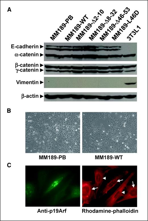 Figure 2. p19Arf does not influence cell morphology or EMT. A, immunoblot analysis of epithelial and mesenchymal proteins in MM189 cells expressing either wild-type p19Arf or the indicated p19Arf mutant proteins. 3T3L1 serves as a positive control for expression of the mesenchymal marker vimentin. β-Actin serves as a loading control. B, phase contrast image of MM189-PB and MM189-WT cells grown for 3 d on a collagen matrix. C, immunofluorescent images of MM189 cells expressing p19Arf and vector controls. Left, p19Arf-positive cells (arrows) are labeled with FITC-conjugated antibodies, whereas p19Arf-negative cells (arrowheads) are not. Right, rhodamine-conjugated phalloidin labels the actin cytoskeleton.