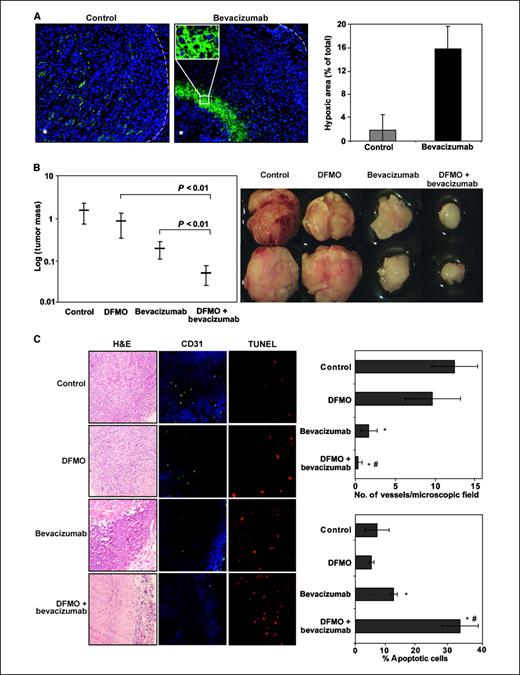 Figure 6. Enhanced tumor growth inhibition by combined targeting of VEGF and ODC. A, bevacizumab treatment induces hypoxia in an experimental glioma tumor model. Human glioma U-87 MG cells (2.5 × 106 in 200 μL PBS) were injected s.c. into the dorsal region of adult female severe combined immunodeficient (SCID) mice and were allowed to form tumors of an approximate size of 5 × 5 mm. Animals were then randomly selected to receive no treatment (Control) or bevacizumab (10 mg/kg, i.p.) twice weekly. After five doses of bevacizumab, tumors of equal size were harvested from control and bevacizumab-treated animals and further processed for evaluation of hypoxia by immunofluorescence staining for GLUT-1 on serial cross sections. Left, representative photomicrographs obtained at ×10 magnification. Whereas control tumors displayed scattered, GLUT-1–positive cells (Alexa Fluor 488–conjugated secondary antibody, green signal), tumors from bevacizumab-treated animals showed a clearly visible area of GLUT-1–positive cells in proximity to the tumor center (white asterisk); white dashed line, periphery of tumor sections. Right, the GLUT-1 positive area was calculated as a fraction of the available total tumor area in representative sections of control and bevacizumab-treated tumors using Image-J software, and expressed as percent of total tumor area. Columns, mean (n = 5); bars, SD. B, U-87 MG tumors were established in SCID mice for 11 d, and animals (n = 6 per group) were randomly divided to receive no treatment (control), DFMO (2% w/v in the drinking water), bevacizumab (10 mg/kg i.p. twice weekly), or DFMO + bevacizumab. Animals were sacrificed and tumor mass was determined after 37 d of treatment. Left, average tumor mass in the respective treatment group; bars, SD. Note logarithmic scale on y-axis. Right, photographs of representative tumors from each treatment group were captured using a 1× objective (Leica MZ 125 Stereomicroscope) equipped with a digital camera. C, left, serial cross sections of formalin-fixed and paraffin-embedded U-87-MG tumors were stained with H&E (left) or analyzed by immunofluorescence microscopy using CD31 (green, middle) antibody or the TUNEL assay (red, right). Right, top, blood vessels were counted in 10 representative microscopic (20×) fields in each group. Columns, mean number of vessels per microscopic field; bars, SD. Bottom, TUNEL-positive cells were counted in representative microscopic fields (20×) in each treatment group. Columns, percent apoptotic cells (n = 5); bars, SD. *, P < 0.05, versus control; #, P < 0.05, versus bevacizumab treatment.