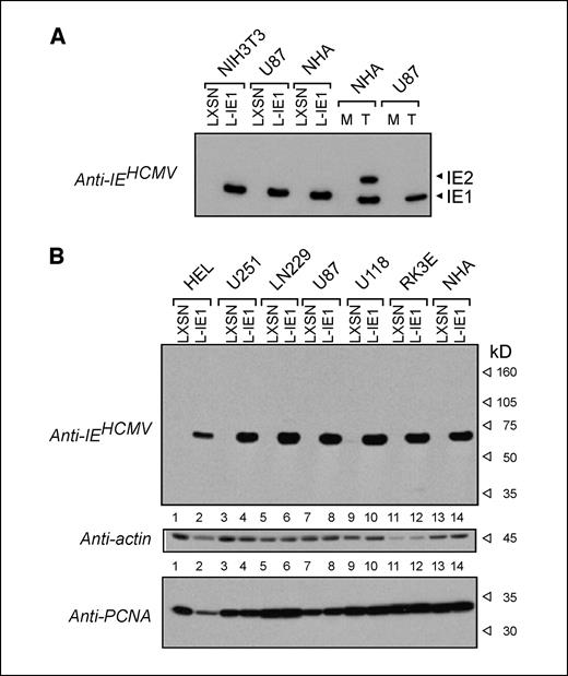 Figure 1. Stable retroviral transduction of HCMV immediate early gene IE1 in fibroblasts, epithelial cells, and astroglial cells. Rodent and human cell lines were transduced with LXSN control and L-IE1 recombinant expression vector by infection with amphotropic helper virus–free retrovirus. Resistant mass populations consisting of >50 individual colonies were generated by G418 selection. A, immunoblot analysis using MAB810 specific for immediate early antigen (IE) of HCMV. Ten micrograms of lysate of recombinant expression sources were compared with cells 72 h following infection with native Towne strain of HCMV (MOI = 5). B, immunoblot analysis of 15-μg protein lysate using monoclonal antibody anti-IE (MAB810), anti-actin, or anti-PCNA.