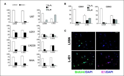 Figure 3. DNA synthesis and cell cycle distribution of glioma tumor cell lines and primary cultures in serum-free conditions. A, control vector– or IE1-transduced nonmalignant human astroglial cells NHA and glioblastomas U87, U251, and LN229 were synchronized by serum starvation for 48 h. Base-level DNA synthesis was measured by BrdUrd incorporation in duplicate (left) and cell cycle distribution by 7-amino-actinomycin D staining in triplicate (right) and analyzed in serum-free conditions by FACS analysis (y-axes: percent total cell number). IE1-mediated changes in BrdUrd incorporation were significant in LN229 and NHA but not U87 or U251. Cell cycle distribution was significantly altered in all four cell lines except G2-M of LN229 and NHA. B, cell cycle analysis of primary glioma cells. Primary glioma cultures (4 × 106 each) derived from two patients were synchronized in mitogen-free conditions for 24 h, transduced by retroviral infection with LXSN control or L-IE1 expression vectors, and subjected to FACS analysis following propidium iodide staining 48 h postinfection (y-axes: percent total cell number). IE1-induced reduction of G0-G1 and increased S and G2-M representation were statistically significant in both GBM1 and GBM2 primary glioma cells. C, immunocytochemical analysis of BrdUrd incorporation and IE1 expression by double immunofluorescence analysis. GBM1 and GBM2 primary glioma cells were pulsed for 30 min with BrdUrd following 72 h of mitogen depletion and 48 h after transduction with L-IE1 or LXSN control vector and processed for double immunofluorescence detection of BrdUrd (green; left) and IE1 (red; right). All nuclei were counterstained with 4′,6-diamidino-2-phenylindole (DAPI; blue). BrdUrd incorporation and IE1 transduction efficiency were quantitated as percentage of positive cells, counting 400 nuclei from representative fields in triplicate for each experimental condition under low power microscopy. Representative fields of GBM1 are depicted at higher magnification. Representative data of at least two independent experiments.